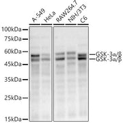 GSK-3α/β Rabbit mAb