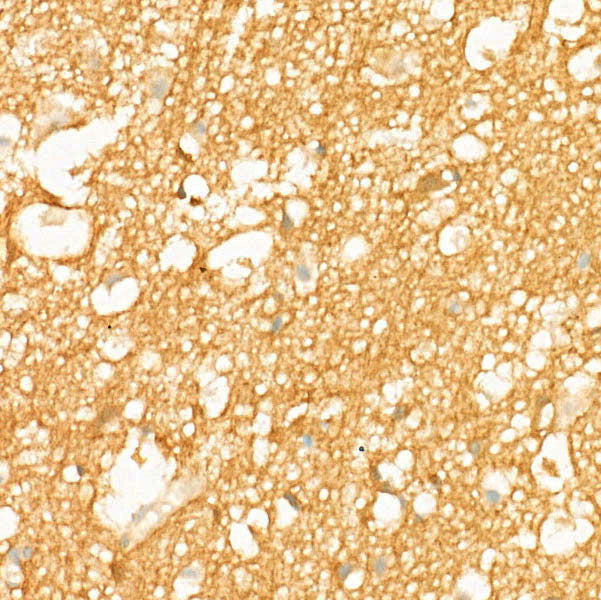 CD171/L1CAM Rabbit mAb