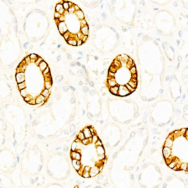 CD171/L1CAM Rabbit mAb