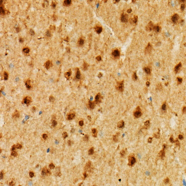 Neurogranin (NRGN) Rabbit mAb