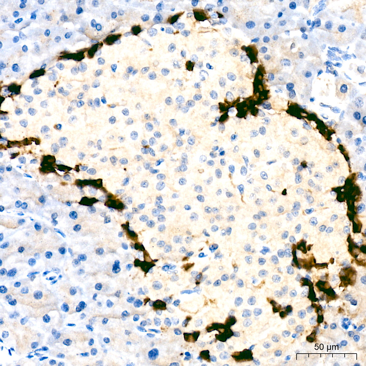 Glucagon Rabbit mAb