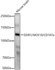 DDR1/MCK10/CD167a Rabbit mAb