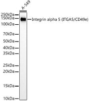 [KD Validated] Integrin alpha 5 (ITGA5/CD49e) Rabbit mAb