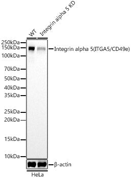 [KD Validated] Integrin alpha 5 (ITGA5/CD49e) Rabbit mAb