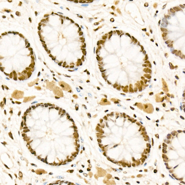 CBX1/HP1 beta Rabbit mAb