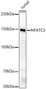 NFATC3 Rabbit mAb