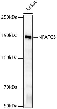 NFATC3 Rabbit mAb