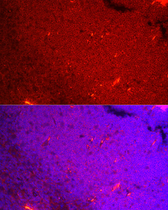 NFATC3 Rabbit mAb