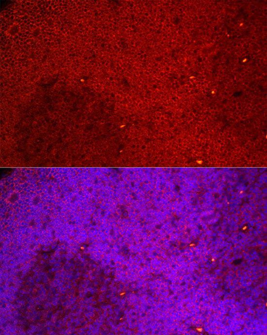 NFATC3 Rabbit mAb