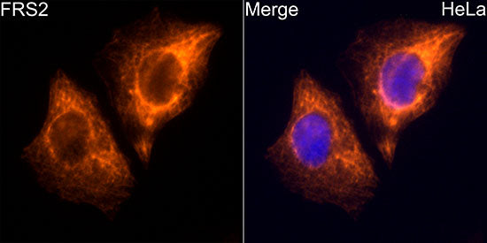 FRS2 Rabbit mAb