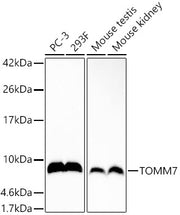 TOMM7 Rabbit mAb