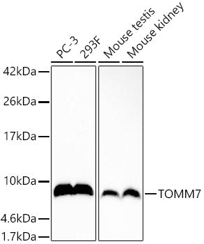 TOMM7 Rabbit mAb