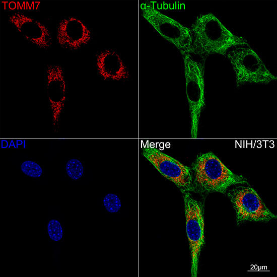TOMM7 Rabbit mAb