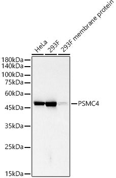 PSMC4 Rabbit mAb