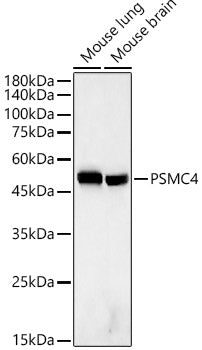 PSMC4 Rabbit mAb