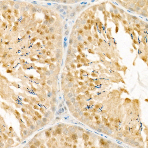 PSMC4 Rabbit mAb