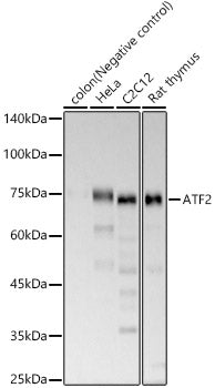 ATF2 Rabbit mAb