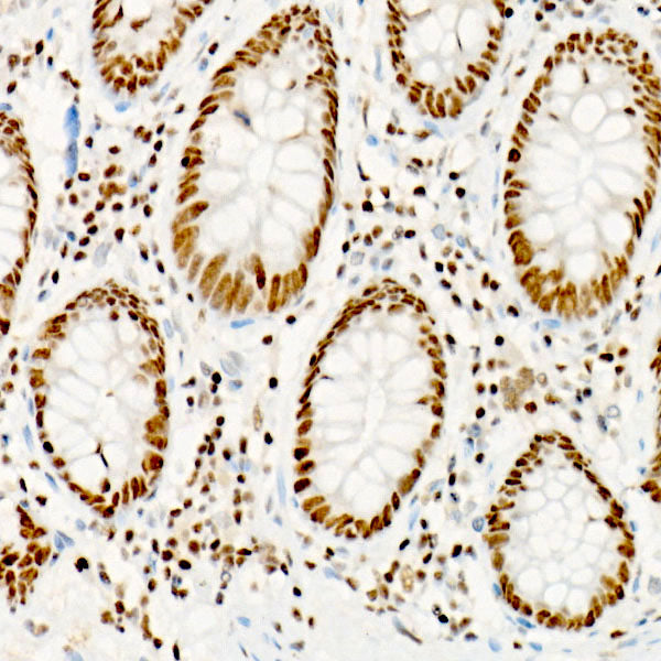 ATF2 Rabbit mAb