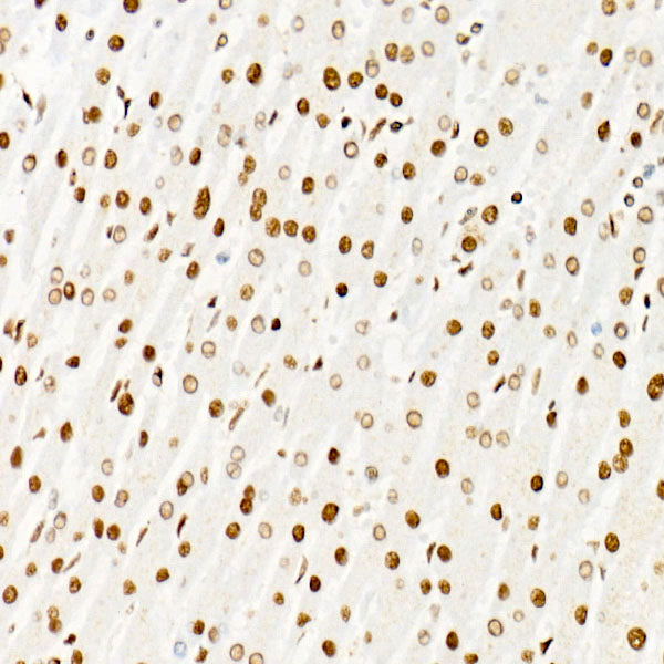 ATF2 Rabbit mAb
