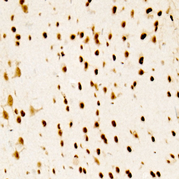 ATF2 Rabbit mAb