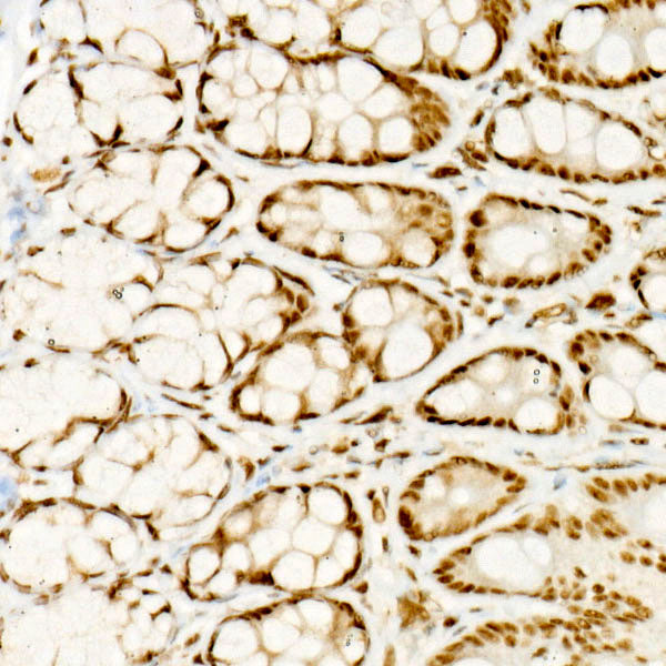 ATF2 Rabbit mAb