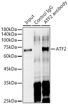 ATF2 Rabbit mAb