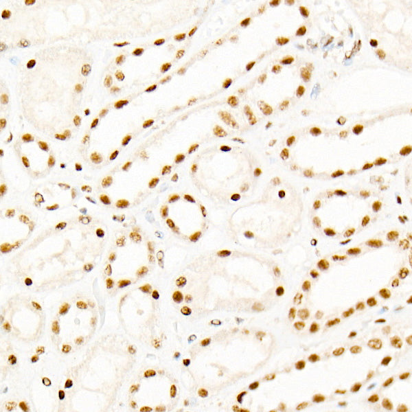 KAT2B/PCAF Rabbit mAb