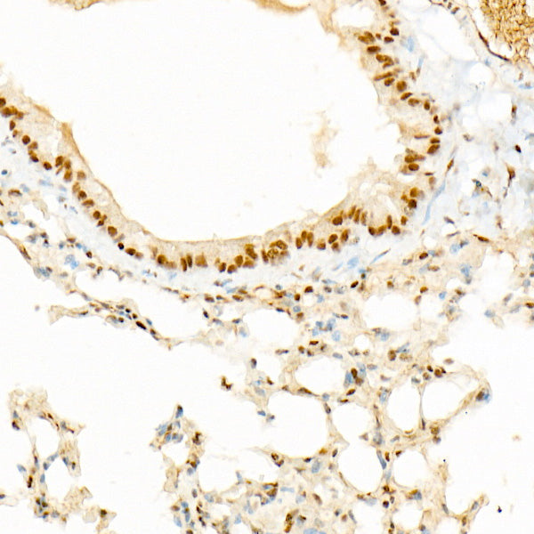 KAT2B/PCAF Rabbit mAb