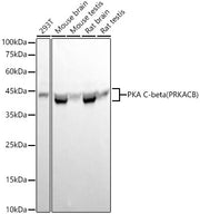 PKA C-beta (PRKACB) Rabbit mAb