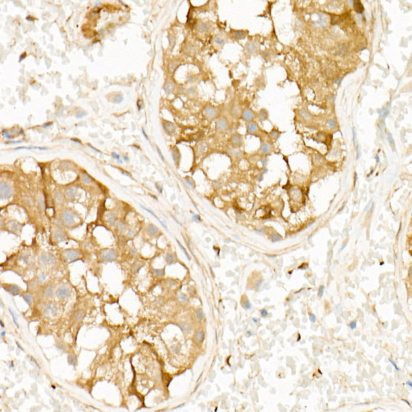 PKA C-beta (PRKACB) Rabbit mAb