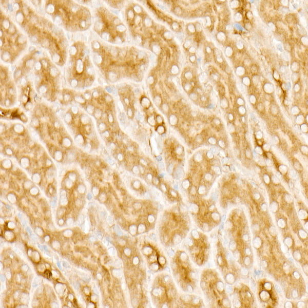 PKA C-beta (PRKACB) Rabbit mAb