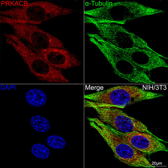 PKA C-beta (PRKACB) Rabbit mAb