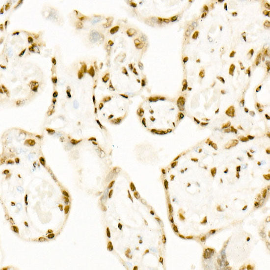 QKI Rabbit mAb