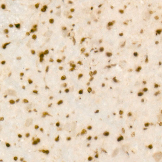QKI Rabbit mAb