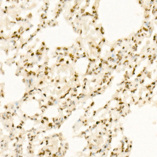 QKI Rabbit mAb