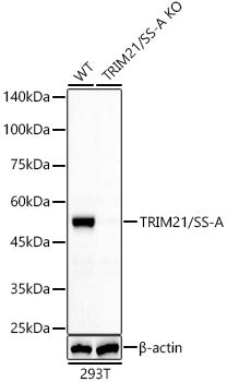 [KO Validated] TRIM21/SS-A Rabbit mAb