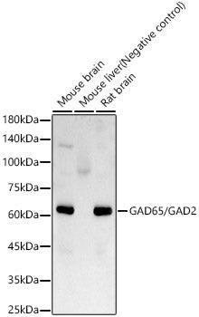 GAD65/GAD2 Rabbit mAb