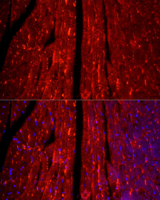 TCAP Rabbit mAb