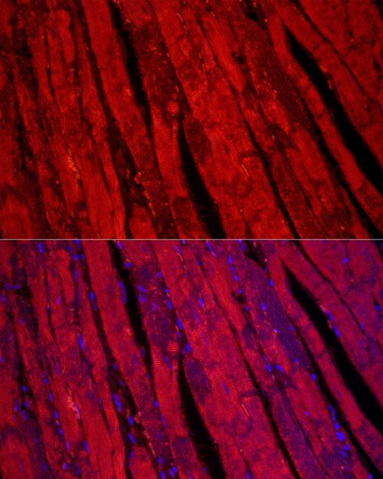 TCAP Rabbit mAb
