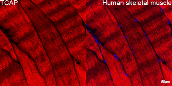 TCAP Rabbit mAb