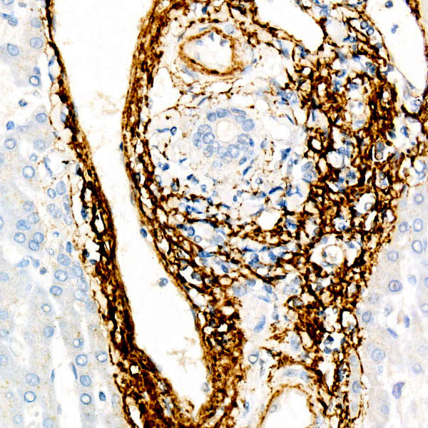 ELN Rabbit mAb