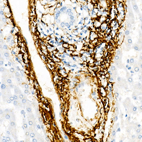 ELN Rabbit mAb