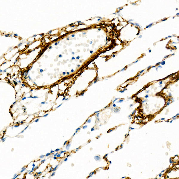 ELN Rabbit mAb
