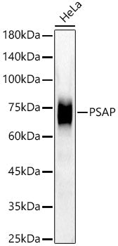 [KD Validated] PSAP Rabbit mAb