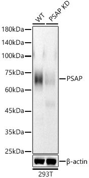 [KD Validated] PSAP Rabbit mAb