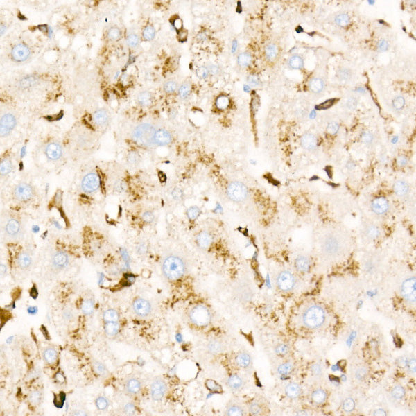 [KD Validated] PSAP Rabbit mAb