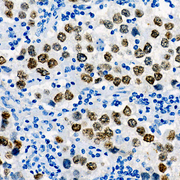 Sall4 Rabbit mAb