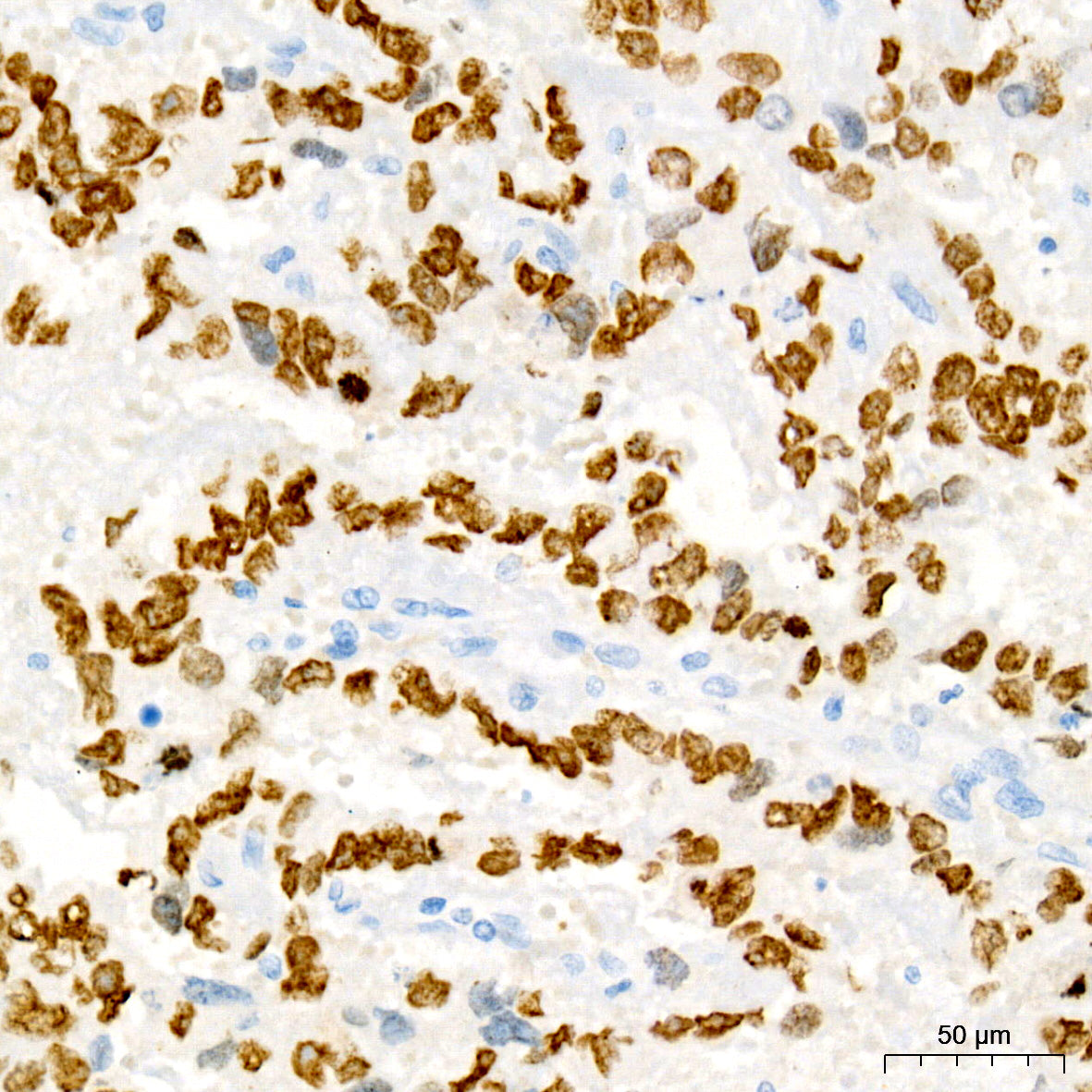 Sall4 Rabbit mAb