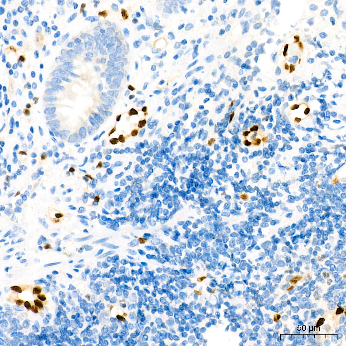 ERG Rabbit mAb