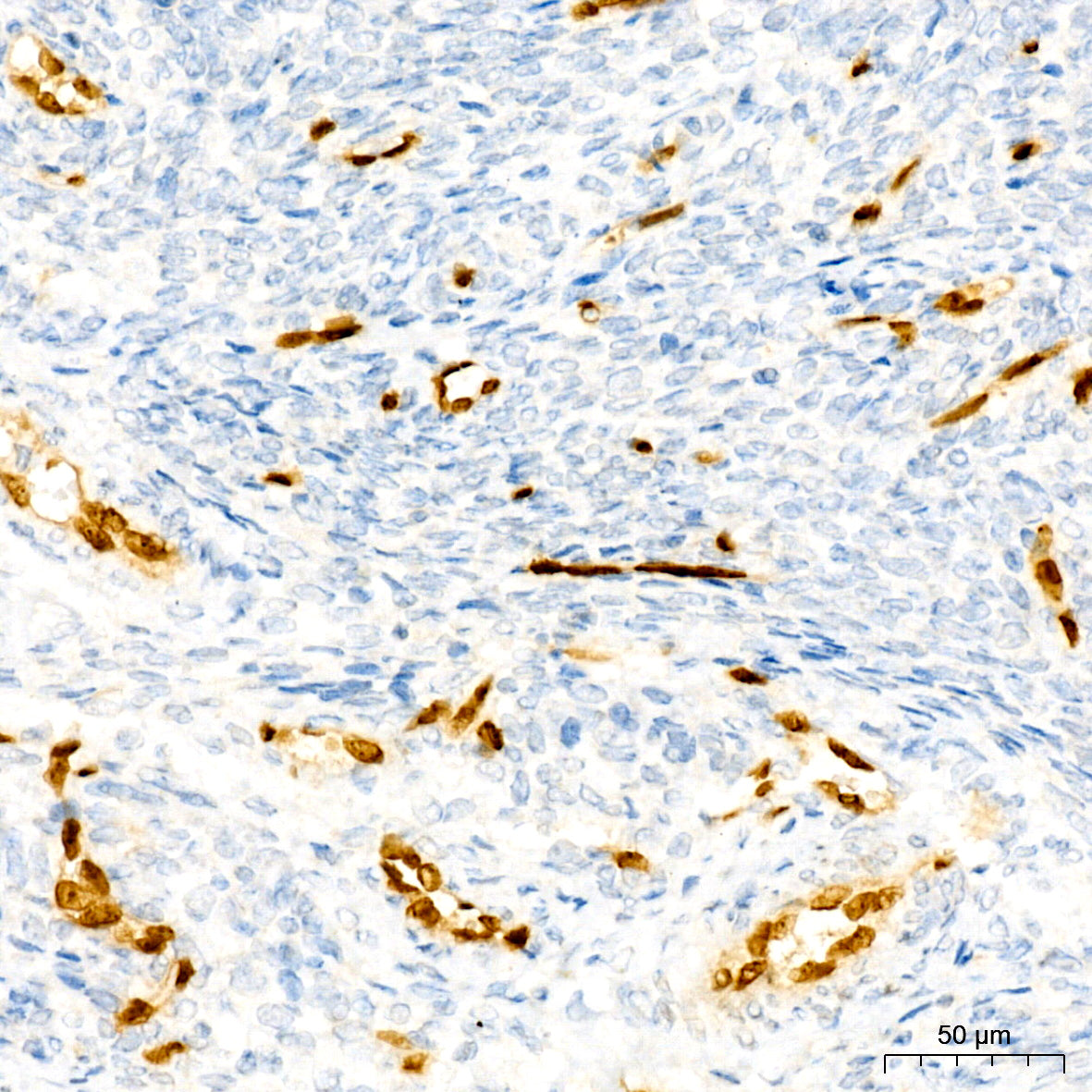 ERG Rabbit mAb